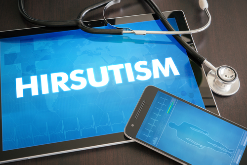 Hirsutism: Causes, Diagnosis and Treatment | HealthSoul