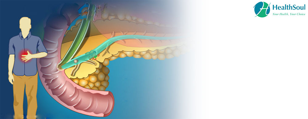 Pancreatic Pseudocyst: Symptoms, Causes and Treatment | HealthSoul