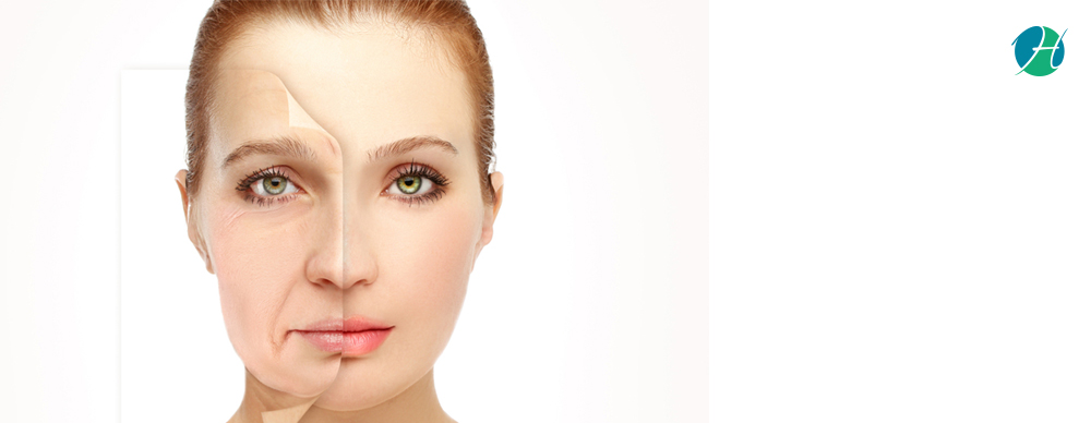 Face-Lifts: Learn More About The Procedure! | HealthSoul