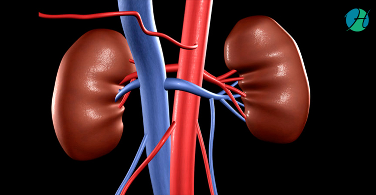 Kidney Transplant | HealthSoul