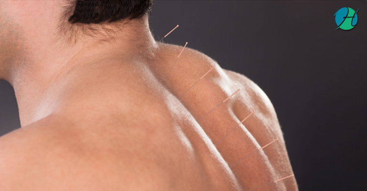 How Massage Can Help Chronic Myofascial Pain Syndrome (CMPS) | HealthSoul