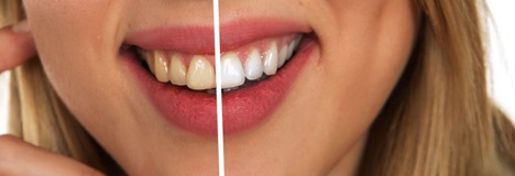 Common Procedures of Cosmetic Dentists in Melbourne | HealthSoul